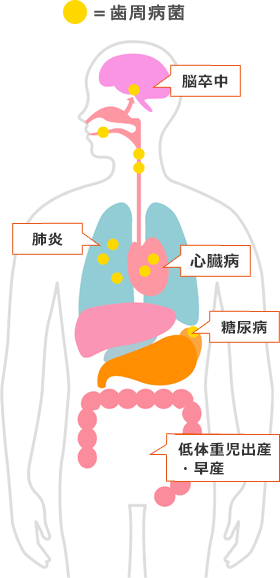 歯周病と全身疾患の関係